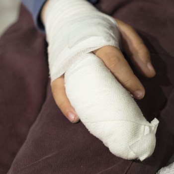 Worker loses two fingers - Company fined